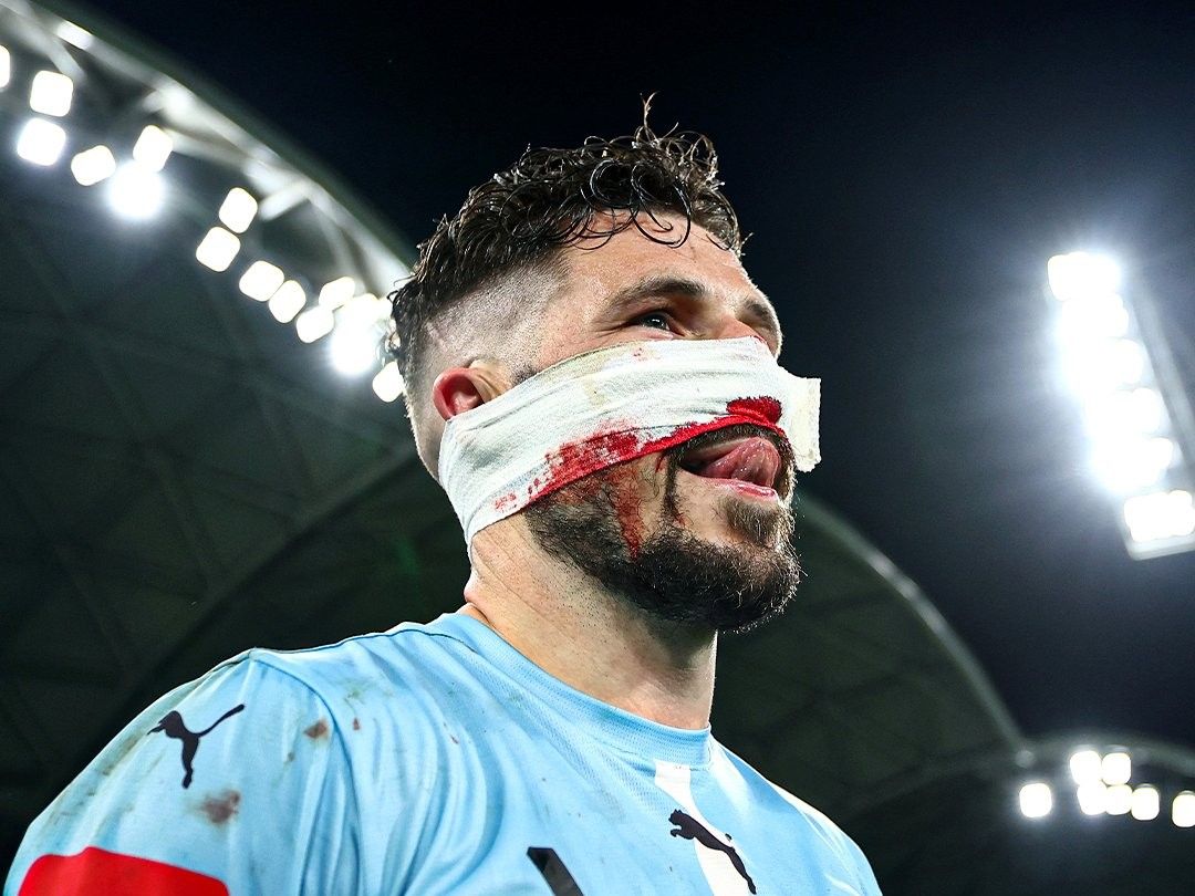 莱基在澳超决赛中面部受伤，不得不退出澳大利亚队大名单